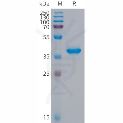 sp-PME101294 S100A9 Fig.1 SDS PAGE 1