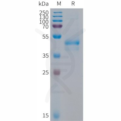 sp-PME101295 ARTN Fig.1 SDS PAGE 1