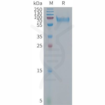 sp-PME101297 IBSP Fig.1 SDS PAGE 1