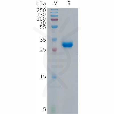 sp-PME101298 p16 Fig.1 SDS PAGE 1