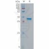 sp-PME101300 p16 Fig.1 SDS PAGE 1