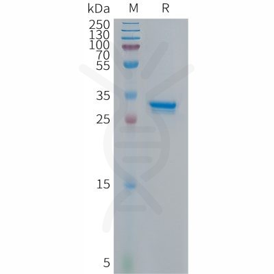 sp-PME101300 p16 Fig.1 SDS PAGE 1