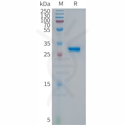 sp-PME101301 p16 Fig.1 SDS PAGE 1