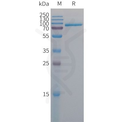 sp-PME101303 MELTF Fig.1 SDS PAGE 1