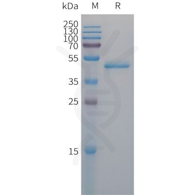 sp-PME101304 PAI1 Fig.1 SDS PAGE 1