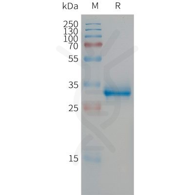 sp-PME101305 CGRP Fig.1 SDS PAGE 1