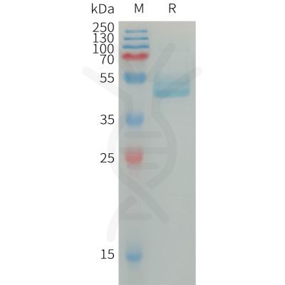 sp-PME101307 IL4 Fig.1 SDS PAGE 1