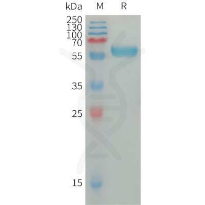 sp-PME101308 IGSF11 Fig.1 SDS PAGE 1