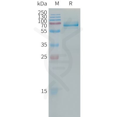 sp-PME101311 LILRB4 Fig.1 SDS PAGE 1