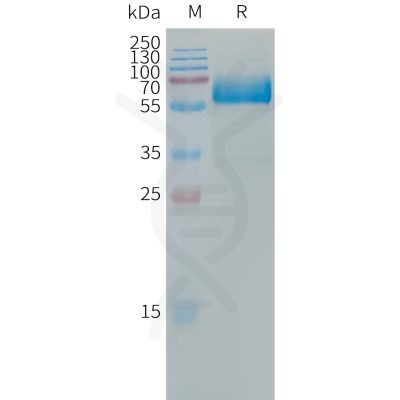 sp-PME101312 LOX 1 Fig.1 SDS PAGE 1