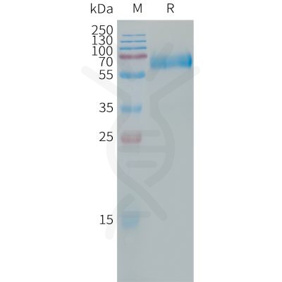 sp-PME101313 CLEC5A Fig.1 SDS PAGE 1