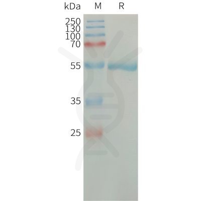 sp-PME101314 CFD Fig.1 SDS PAGE 1