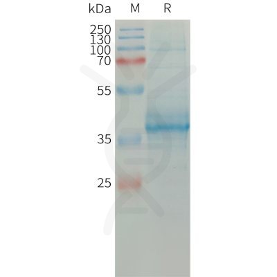 sp-PME101315 CCL11 Fig.1 SDS PAGE 1