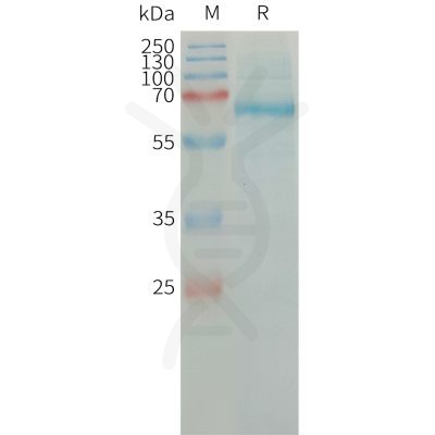 sp-PME101316 PLAT Fig.1 SDS PAGE 1