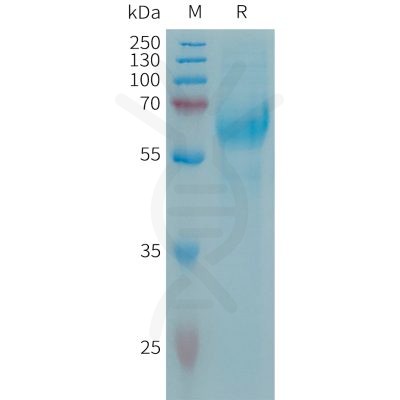 sp-PME101319 CSPG5 Fig.1 SDS PAGE 1