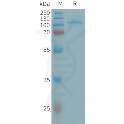 sp-PME101320 ENPP2 Fig.1 SDS PAGE 1