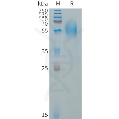 sp-PME101322 CD79A Fig.1 SDS PAGE 1