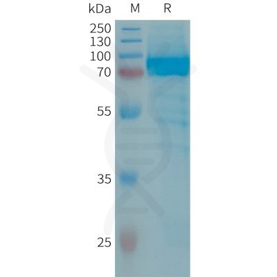 sp-PME101325 IL13RA2 Fig.1 SDS PAGE 1