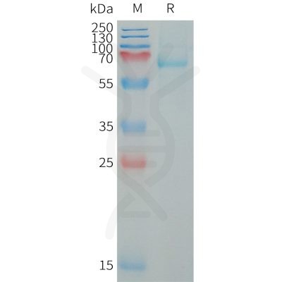 sp-PME101327 LILRB5 Fig.1 SDS PAGE 1