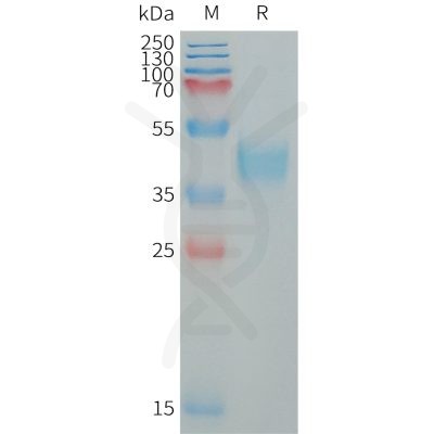 sp-PME101328 MXRA8 Fig.1 SDS PAGE 1