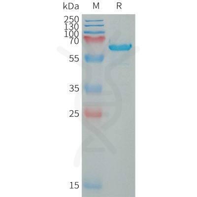 sp-PME101329 WFDC1 Fig.1 SDS PAGE 1