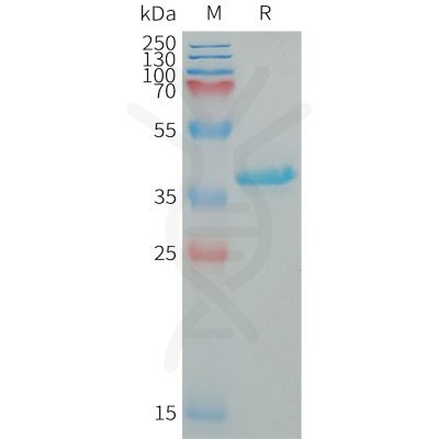 sp-PME101330 IGF1 Fig.1 SDS PAGE 1