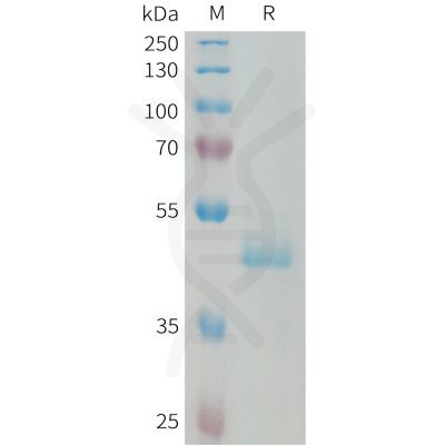 sp-PME101331 PIP Fig.1 SDS PAGE 1 1