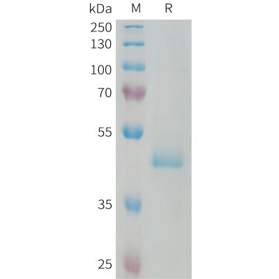 sp-PME101331 PIP Fig.1 SDS PAGE 1