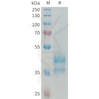 sp-PME101332 CCL24 Fig.1 SDS PAGE 1 1