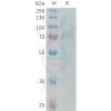 sp-PME101333 RTN4R Fig.1 SDS PAGE 1 1