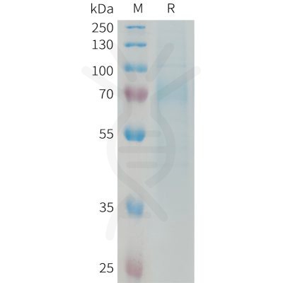 sp-PME101333 RTN4R Fig.1 SDS PAGE 1 1