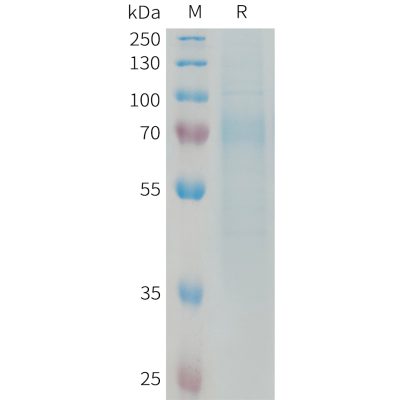 sp-PME101333 RTN4R Fig.1 SDS PAGE 1