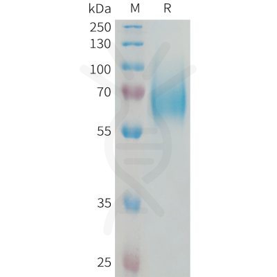 sp-PME101334 FGFR1 Fig.1 SDS PAGE 1 1