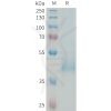 sp-PME101336 KIR3DL3 Fig.1 SDS PAGE 1 1