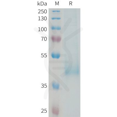 sp-PME101336 KIR3DL3 Fig.1 SDS PAGE 1 1