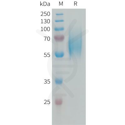 sp-PME101337 FGFR2 Fig.1 SDS PAGE 1 1