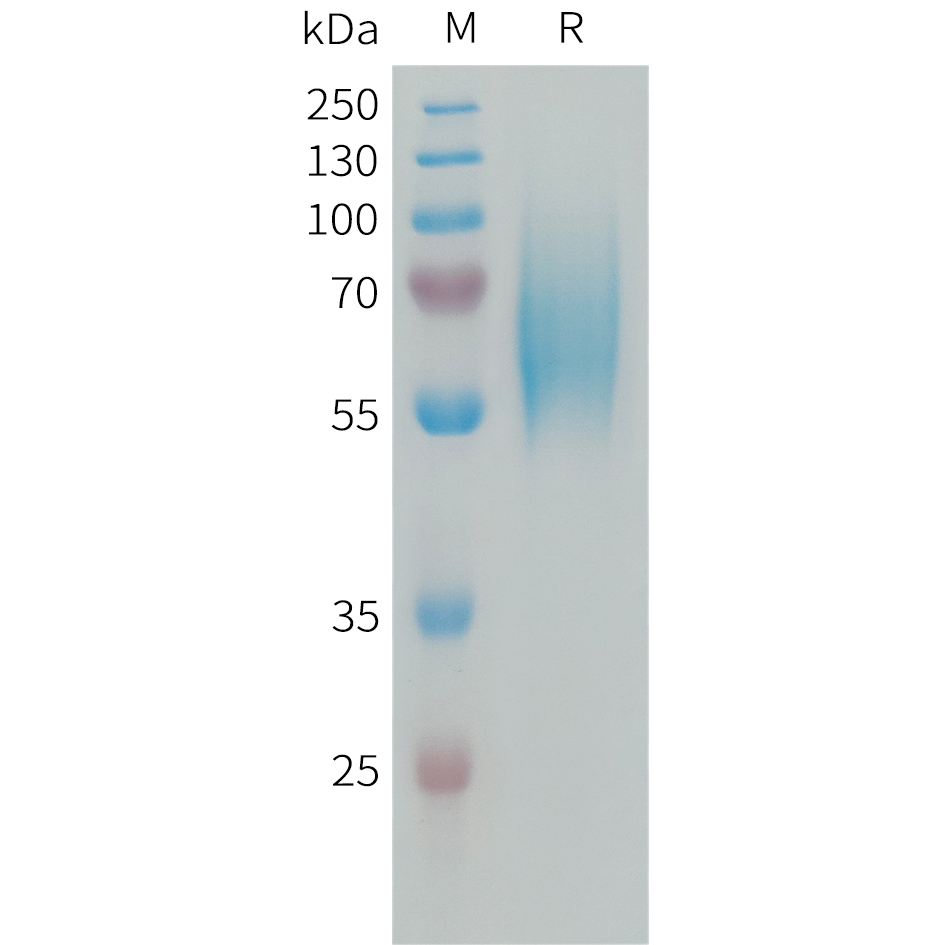 PME101337-FGFR2-Fig.1-SDS-PAGE-1.jpg