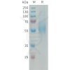 sp-PME101338 MSR1 Fig.1 SDS PAGE 1 1