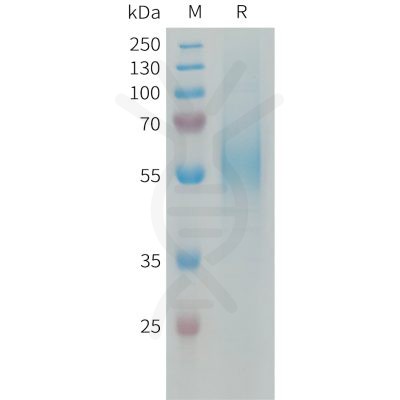 sp-PME101338 MSR1 Fig.1 SDS PAGE 1 1