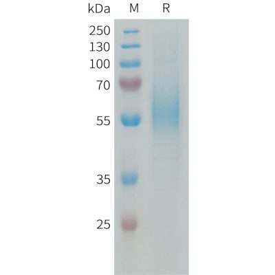 sp-PME101338 MSR1 Fig.1 SDS PAGE 1