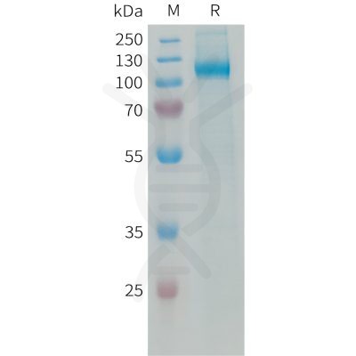 sp-PME101339 AOC3 Fig.1 SDS PAGE 1 1