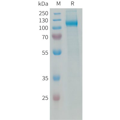 sp-PME101339 AOC3 Fig.1 SDS PAGE 1