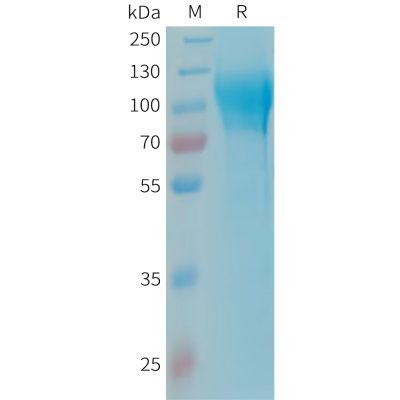 sp-PME101341 MAG Fig.1 SDS PAGE 1