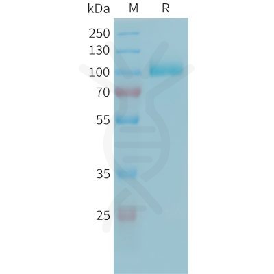 sp-PME101342 C2 Fig.1 SDS PAGE 1