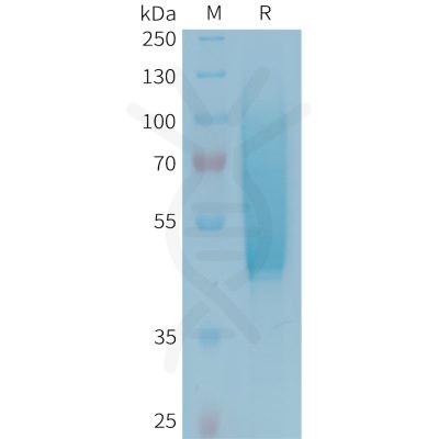 sp-PME101343 CX3CL1 Fig.1 SDS PAGE 1 1