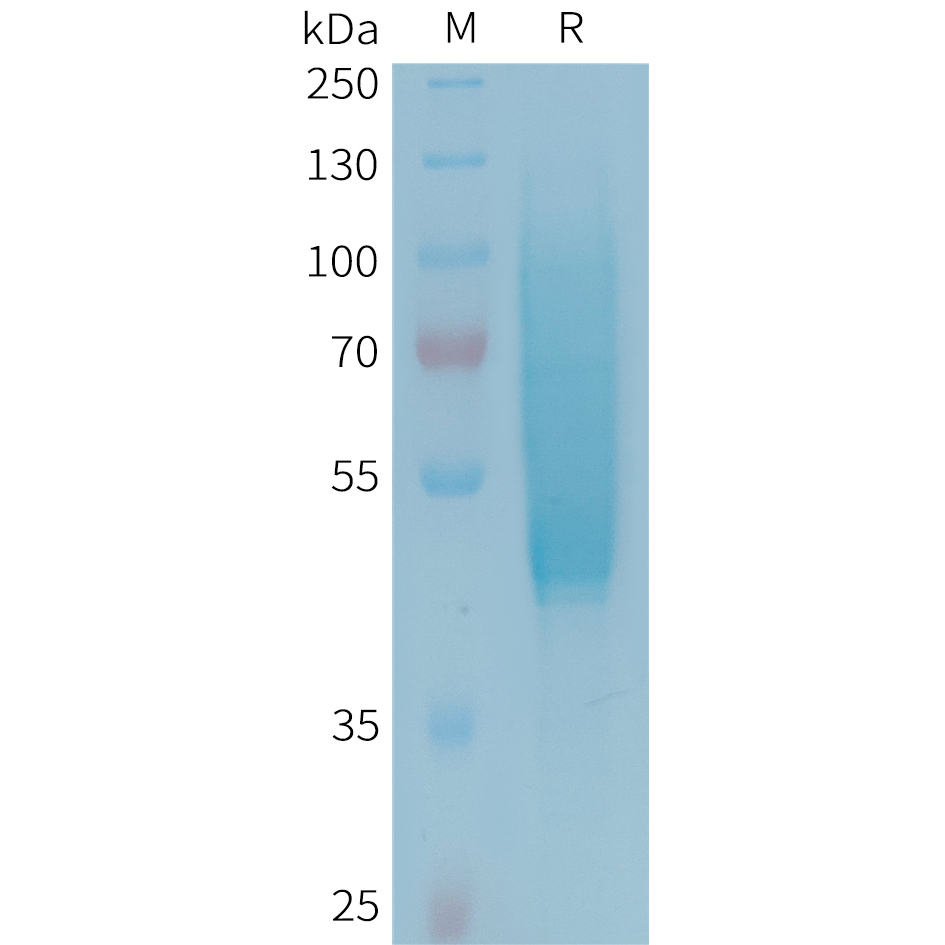 PME101343-CX3CL1-Fig.1-SDS-PAGE-1.jpg