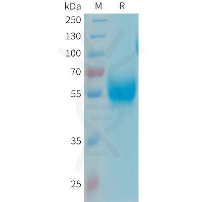 sp-PME101344 APOH Fig.1 SDS PAGE 1