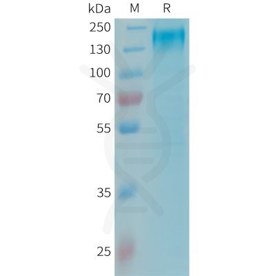 sp-PME101345 LEPR Fig.1 SDS PAGE 1