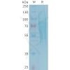 sp-PME101346 TREML2 Fig.1 SDS PAGE 1