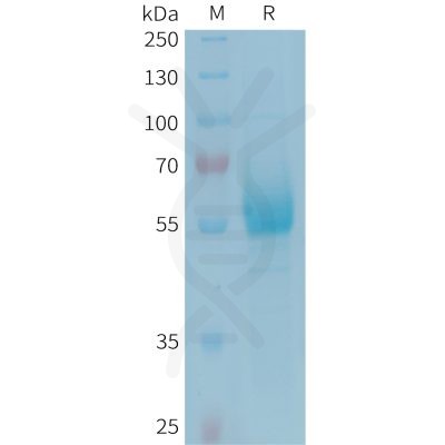 sp-PME101350 CD161 Fig.1 SDS PAGE 1